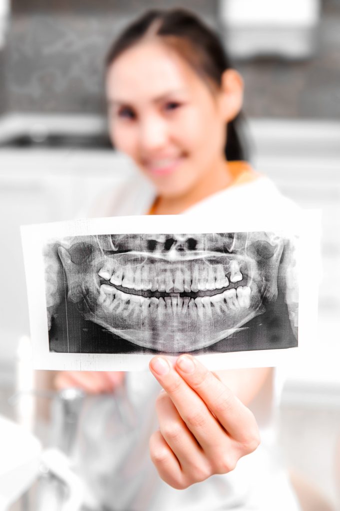 Dentist looking at x-ray picture in the office